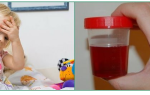 Как спасти детей от гломерулонефрита