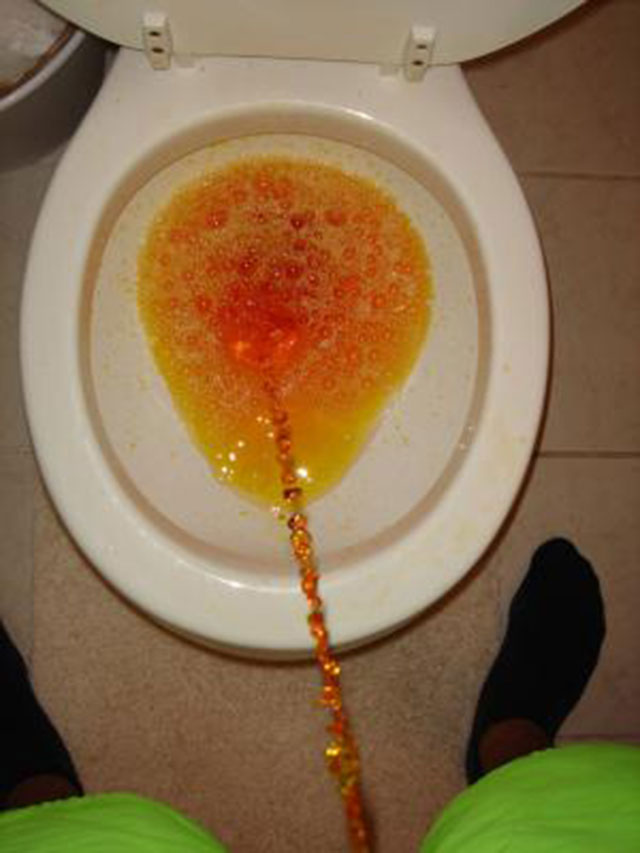 Урина цвета цитрусовых в туалете