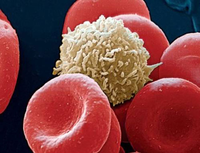 Как выглядят лейкоциты в крови под микроскопом фото