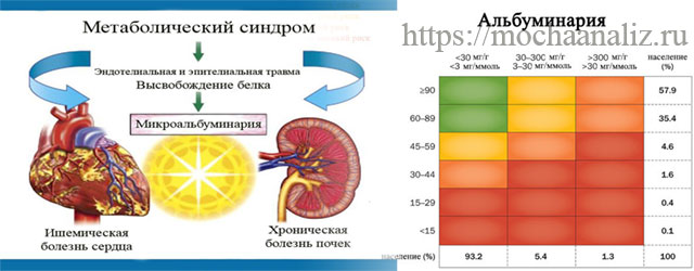 Микроальбумин норма у женщин. Исследование мочи на МАУ. Моча по МАУ. МАУ норма в моче. Забор мочи на МАУ.