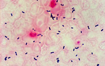 Enterococcus fecal