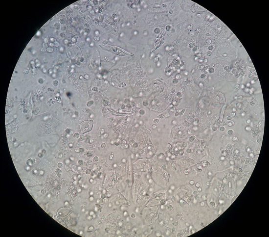 Эстераза под микроскопом