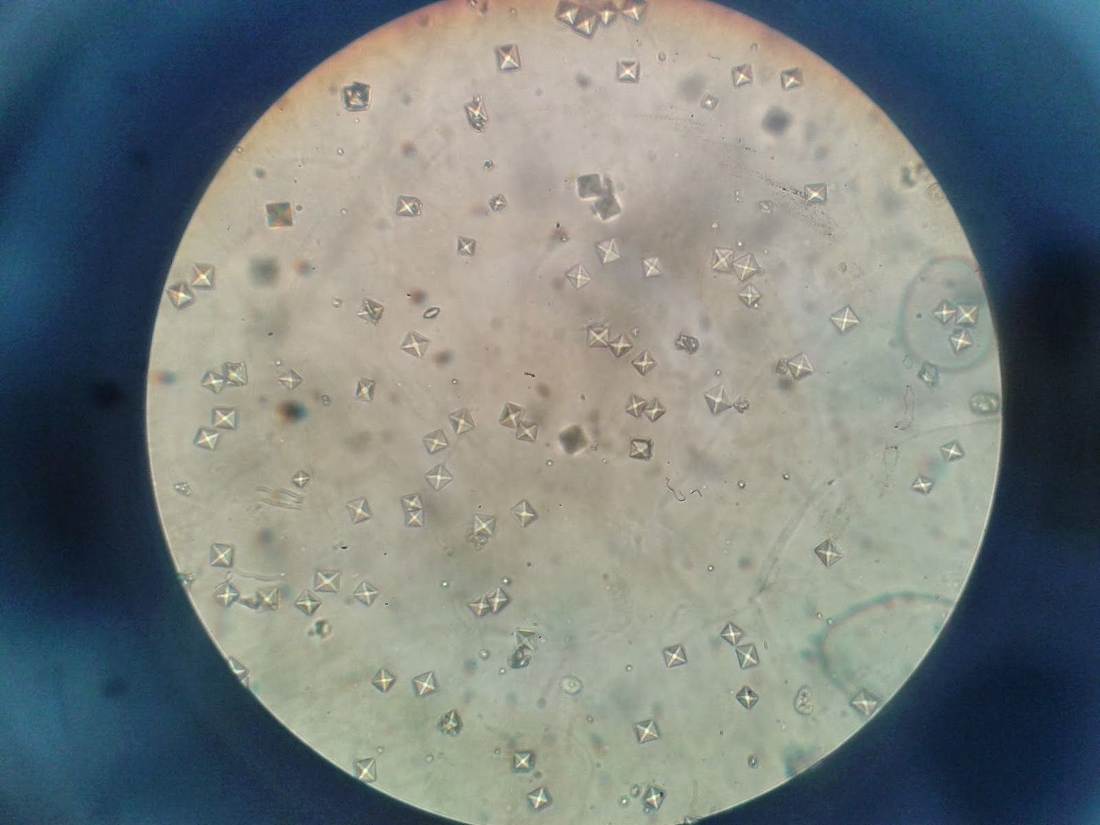 Фосфаты в какой моче. Оксалаты кальция в моче под микроскопом. Оксалат кальция под микроскопом. Оксалаты кальция в моче микроскопия. Оксалаты в моче микроскопия.